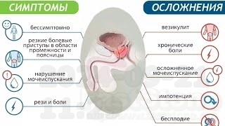    zb prostatic